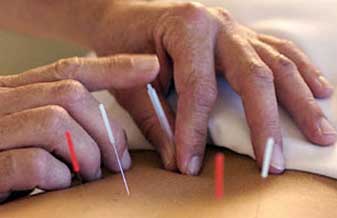 Aban-Academia Brasileira de Acupuntura Reflexa e Naturopatia - Foto 1