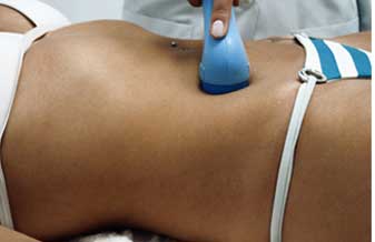 José Araujo Holanda Filho - Foto 1